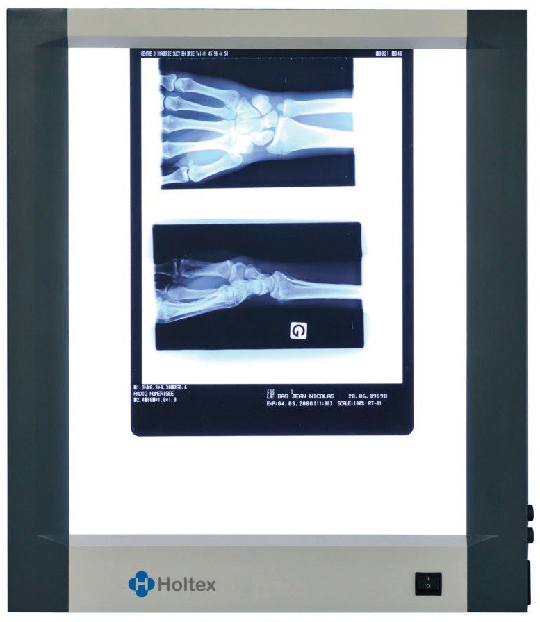 Négatoscope extra-plat