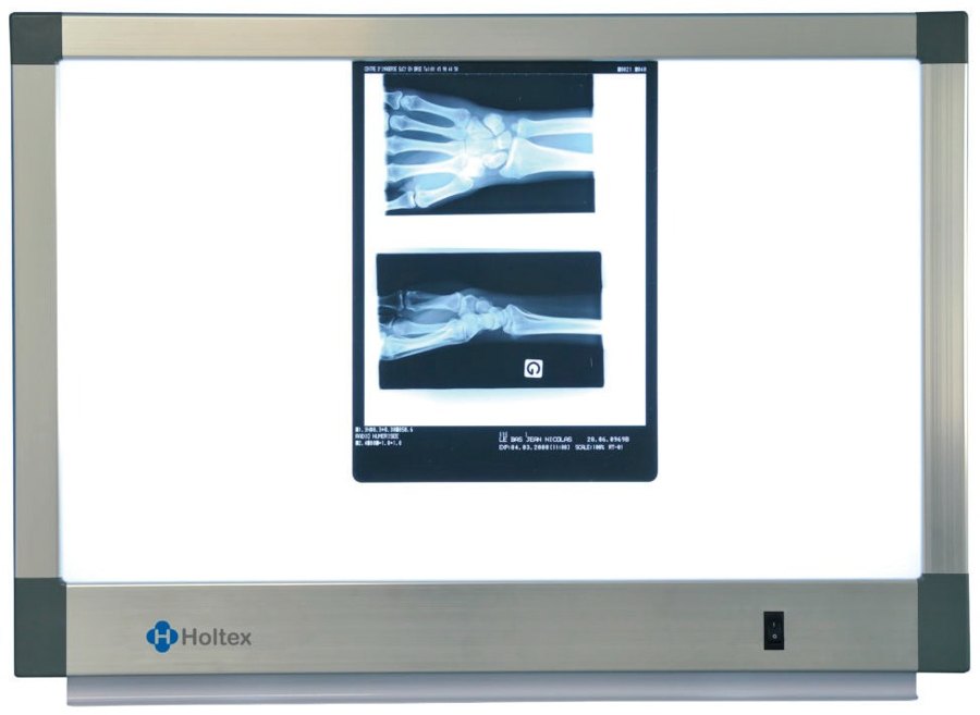 Négatoscope standard 2 plages